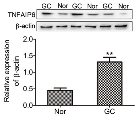 TNFAIP6 protein expression was assayed by western blotting.jpg